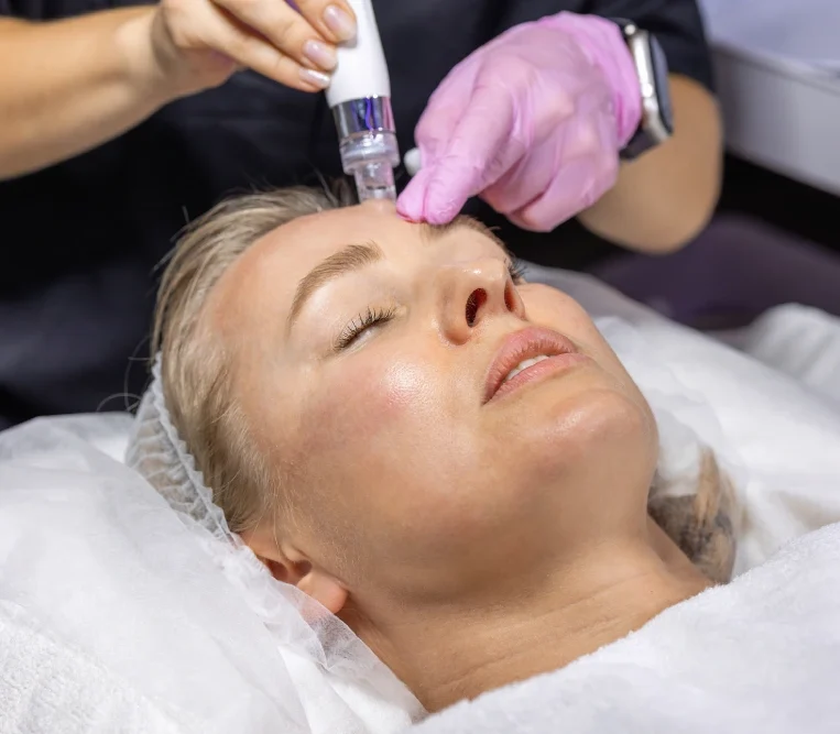 Practitioner in pink gloves performing microneedling treatment on patient's forehead
